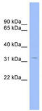 CCR4-NOT Transcription Complex Subunit 7 antibody, TA330624, Origene, Western Blot image 