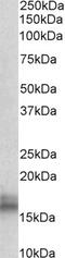 ME1 antibody, EB10804, Everest Biotech, Western Blot image 