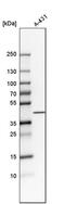 Nedd4 Family Interacting Protein 2 antibody, PA5-52657, Invitrogen Antibodies, Western Blot image 
