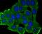 Matrix Metallopeptidase 17 antibody, A08090-1, Boster Biological Technology, Immunocytochemistry image 