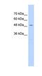 UV excision repair protein RAD23 homolog A antibody, NBP1-52942, Novus Biologicals, Western Blot image 