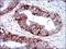 Insulin Like Growth Factor 1 Receptor antibody, NB110-87052, Novus Biologicals, Immunohistochemistry frozen image 