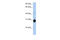 Ras Homolog Family Member U antibody, 25-685, ProSci, Enzyme Linked Immunosorbent Assay image 