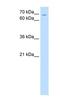 Zinc Finger Protein 131 antibody, NBP1-79228, Novus Biologicals, Western Blot image 