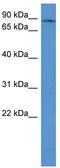 Gamma-adducin antibody, TA342787, Origene, Western Blot image 