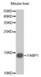 Fatty Acid Binding Protein 1 antibody, abx004060, Abbexa, Western Blot image 
