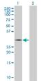 Thiamine Triphosphatase antibody, H00079178-D01P, Novus Biologicals, Western Blot image 