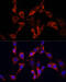 Segment polarity protein dishevelled homolog DVL-2 antibody, 23-022, ProSci, Immunofluorescence image 