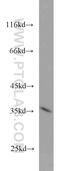 Steap antibody, 20199-1-AP, Proteintech Group, Western Blot image 