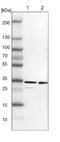Thioredoxin Domain Containing 9 antibody, NBP1-89052, Novus Biologicals, Western Blot image 