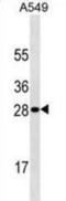 Hypoxanthine Phosphoribosyltransferase 1 antibody, abx025466, Abbexa, Western Blot image 