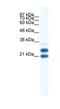 Tripartite Motif Containing 34 antibody, NBP1-80050, Novus Biologicals, Western Blot image 