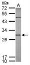 Synaptosome Associated Protein 25 antibody, NBP1-33714, Novus Biologicals, Western Blot image 