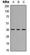 Homeobox C10 antibody, LS-C354397, Lifespan Biosciences, Western Blot image 