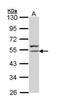 Keratin 8 antibody, PA5-29607, Invitrogen Antibodies, Western Blot image 