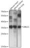 Ubiquitin Conjugating Enzyme E2 J1 antibody, A15841, ABclonal Technology, Western Blot image 