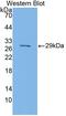 Signal-regulatory protein beta-1 antibody, MBS2026866, MyBioSource, Western Blot image 