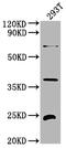 Fibroblast Growth Factor 19 antibody, CSB-PA008624EA01HU, Cusabio, Western Blot image 
