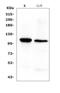 Notch Receptor 2 antibody, A00518-2, Boster Biological Technology, Western Blot image 