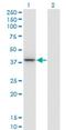 Parvin Gamma antibody, H00064098-M01, Novus Biologicals, Western Blot image 