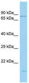 Spindle Apparatus Coiled-Coil Protein 1 antibody, TA331882, Origene, Western Blot image 