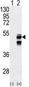 Protein Phosphatase, Mg2+/Mn2+ Dependent 1F antibody, GTX50878, GeneTex, Western Blot image 