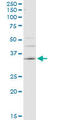 Carbonic Anhydrase 4 antibody, LS-C196793, Lifespan Biosciences, Western Blot image 