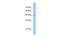 Tigger Transposable Element Derived 3 antibody, PA5-43276, Invitrogen Antibodies, Western Blot image 