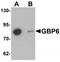 Guanylate Binding Protein Family Member 6 antibody, TA320124, Origene, Western Blot image 