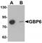 Guanylate Binding Protein Family Member 6 antibody, TA320124, Origene, Western Blot image 