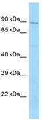 RAP1 GTPase Activating Protein 2 antibody, TA333850, Origene, Western Blot image 