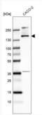 Treacle Ribosome Biogenesis Factor 1 antibody, NBP1-86908, Novus Biologicals, Western Blot image 