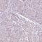 Nuclear VCP Like antibody, PA5-55801, Invitrogen Antibodies, Immunohistochemistry frozen image 