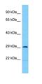 Ankyrin Repeat Domain 44 antibody, orb331422, Biorbyt, Western Blot image 