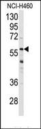 Cytochrome P450 Family 3 Subfamily A Member 4 antibody, AP14581PU-N, Origene, Western Blot image 
