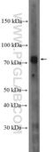 5-Methyltetrahydrofolate-Homocysteine Methyltransferase Reductase antibody, 26944-1-AP, Proteintech Group, Western Blot image 