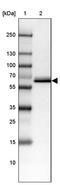 Carboxylesterase 3 antibody, PA5-59507, Invitrogen Antibodies, Western Blot image 