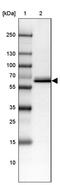 TGH antibody, PA5-59507, Invitrogen Antibodies, Western Blot image 