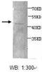 Actin Gamma 1 antibody, TA310035, Origene, Western Blot image 