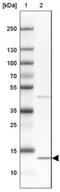 CDGSH Iron Sulfur Domain 3 antibody, NBP2-30633, Novus Biologicals, Western Blot image 