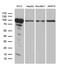 Glycogen Phosphorylase, Muscle Associated antibody, M02971, Boster Biological Technology, Western Blot image 