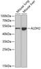 Aldehyde Dehydrogenase 2 Family Member antibody, GTX55502, GeneTex, Western Blot image 