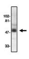 C-C chemokine receptor type 8 antibody, orb108747, Biorbyt, Western Blot image 