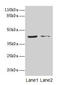 Mitogen-Activated Protein Kinase 13 antibody, CSB-PA013452LA01HU, Cusabio, Western Blot image 