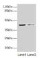 Mitogen-activated protein kinase 13 antibody, CSB-PA013452LA01HU, Cusabio, Western Blot image 