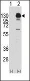 Platelet Derived Growth Factor Receptor Alpha antibody, 63-118, ProSci, Western Blot image 