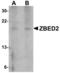 Zinc Finger BED-Type Containing 2 antibody, MBS150139, MyBioSource, Western Blot image 