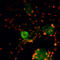 Transient Receptor Potential Cation Channel Subfamily A Member 1 antibody, A00453, Boster Biological Technology, Western Blot image 