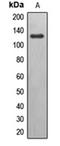 EPH Receptor B6 antibody, orb213900, Biorbyt, Western Blot image 