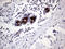 Anterior Gradient 2, Protein Disulphide Isomerase Family Member antibody, LS-C798729, Lifespan Biosciences, Immunohistochemistry paraffin image 